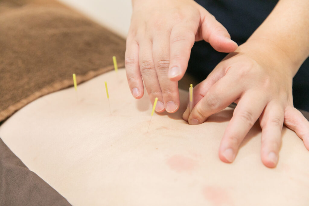鍼灸 はり きゅう 代官山 中目黒 女性専門